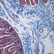 9815-22 Theory and Mechanisms of Histopathological Staining