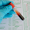 9908-22 Clinical Significance of Sodium and Potassium in Blood