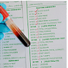 9875-15_ Erythrocyte Sedimentation Rate
