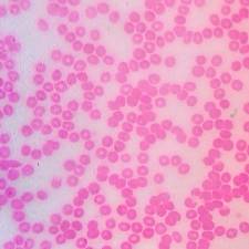 9918.18 Hematology Testing and Slide Image Review: Red Blood Cells (RBC)