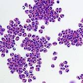 9919.18 Hematology Testing and Slide Image Review: White Blood Cells (WBC) and Body Fluids
